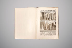 Página de livro com o título "Colaterais deltas e ramificações parietais cuja repleção foi feita com a pasta Alfacanal", mostrando oito radiografias dentárias com setas e legendas indicando estruturas como "interconduto", "delta" e "colateral".